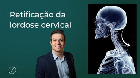 O Que É Retificação Da Lordose Cervical - Retificação da Lordose Fisiológica Cervical: Causas e Tratamentos ...