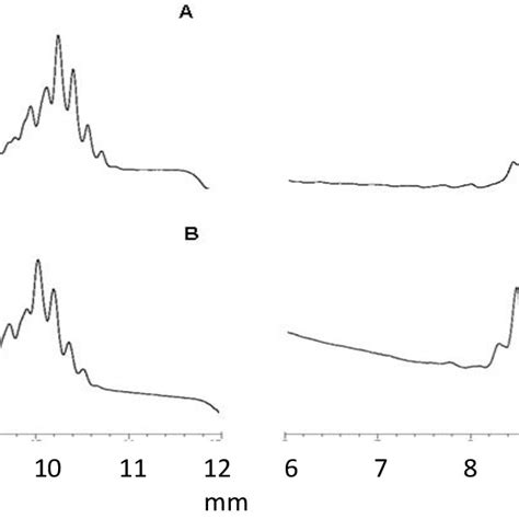 Representative Reverse Phase Hplc Chromatograms Of Mycolic Acid