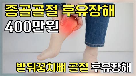 발뒤꿈치뼈 종골 골절 후유장해 보험금 400만 원 Youtube