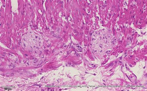 Auerbach Plexus - Histology of Esophagus, Stomach, Intestines ...