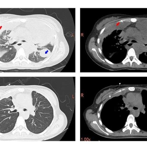 Chest Computed Tomography The Chest Computed Tomography Results Download Scientific Diagram