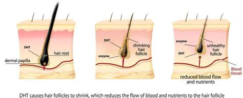 Does Smoking Cause the Loss of Hair? – HairBro