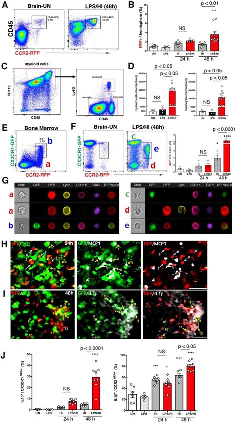 CCR2 RFP CX3CR1 GFP Monocytic Infiltrates In Neonatal R G Mouse