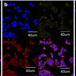 Gel Electrophoresis For SiRNA Loaded PLGA And CS PLGA Nanoparticles A