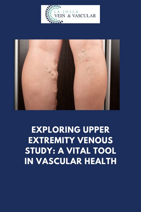 Upper Extremity Venous Study: A Vital Tool in Vascular Health