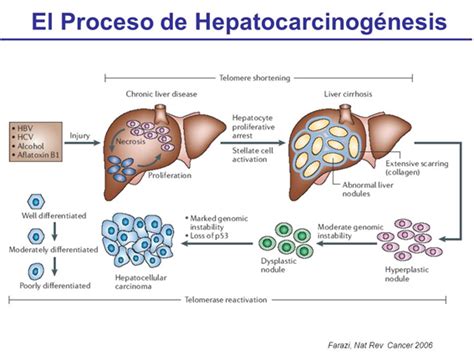 Carcinoma Hepatocelular Do Quadro Cl Nico Ao Progn Stico