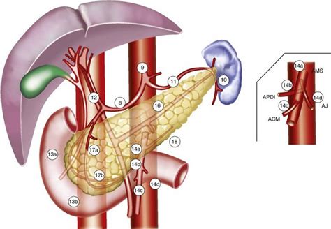 Pancreatic Cancer Oncohema Key