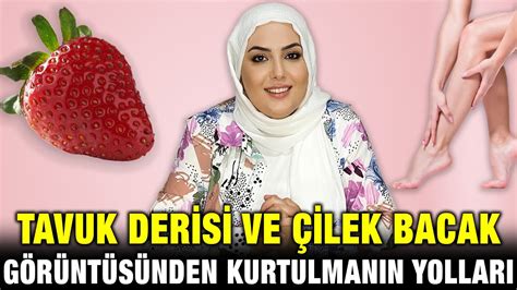 Tavuk Derisi ve Çilek Bacak Görüntüsünden Kurtulmanın Yolları