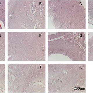 Mt Staining For Native Uterine Tissue A And Decellularized Uterine