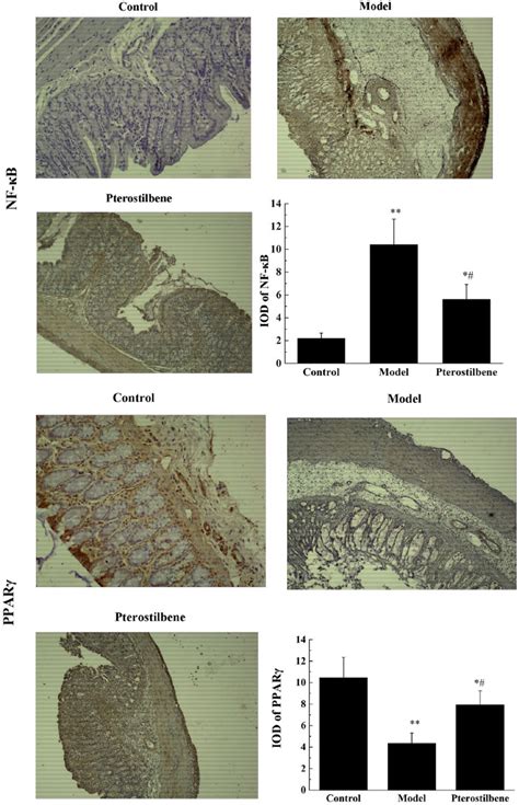 Effects Of Pterostilbene On The Expression Of Nf B And Ppar In