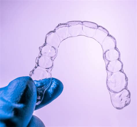 What are Aligners? - Odsaligners Com - Medium