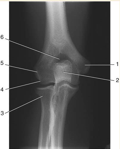 Label Anatomy Elbow Flashcards Quizlet