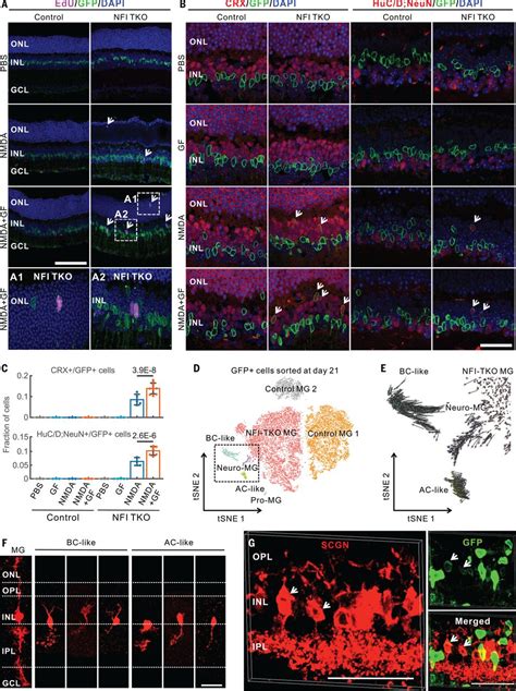 Gene Regulatory Networks Controlling Vertebrate Retinal Regeneration