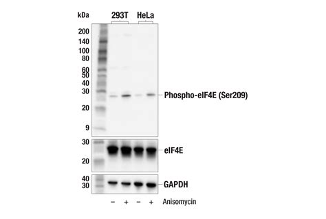 Phospho Eif4e Ser209 F4e5n Rabbit Mab Cell Signaling Technology