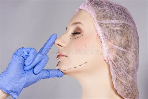 Chirurgie Plastique Femme Avec Des Lignes De Perforation Sur Le Visage