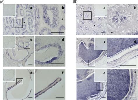 Photomicrographs Of Testis Sections Ab Epididymis Sections Cd