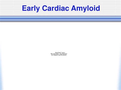 PPT - Echocardiography of Cardiac Amyloidosis PowerPoint Presentation ...