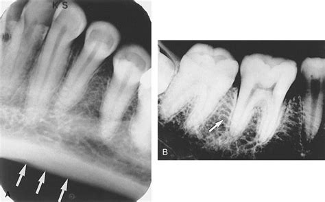 3 Anatomy And Physiology Pocket Dentistry