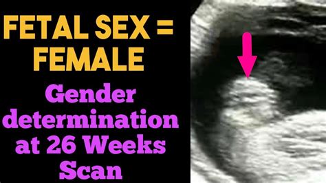 Fetal Sex Female Gender Determination At 26 Weeks Scan Youtube