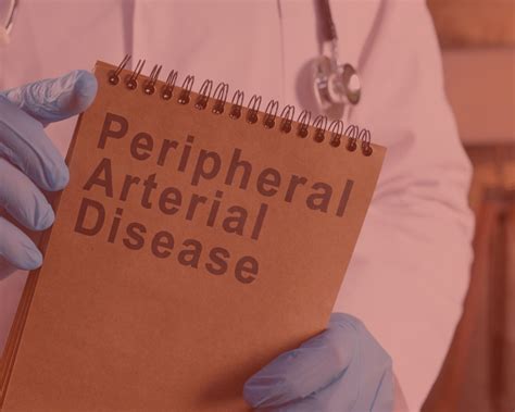 Peripheral Arterial Disease Pad Treatments What Are They Blog