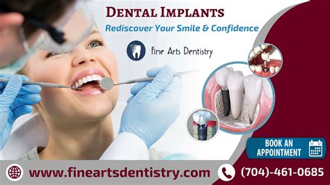 Dental Implant Restorations In Matthews L Fine Arts Dentistry Dental