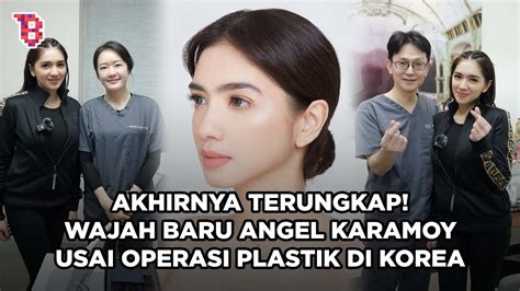 Potret Terbaru Angel Karamoy Usai Operasi Plastik Di Korea Dipuji