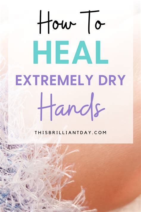 How To Heal Extremely Dry Hands 7 Natural Remedies Extremely Dry Hands Dry Cracked Hands