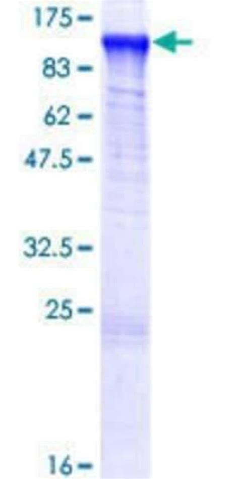 Novus Biologicals Recombinant Human MED24 GST N Term Protein 10 μg