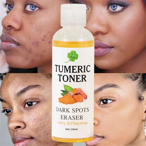 Turmeric Toner Dark Spots Eraser Brightening Skin Even Skin Tone Fades