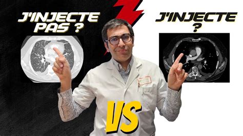 Œdème Aigu Pulmonaire VS Embolie scanner ou angioscanner YouTube