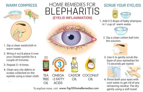 Blepharitis - IMU computer group 6 Treat the disease not the symptom