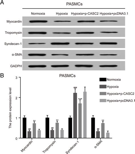 LncRNA CASC2 Suppressed Phenotype Switch Induced By Hypoxia In PASMCs