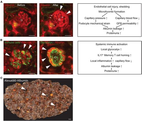 Representative Intravital Mpm Images Of Glomerular Endothelial Injury