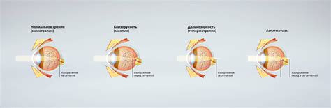Хорошее зрение: шкала зрения, какое считается нормальным oculistic.ru ...