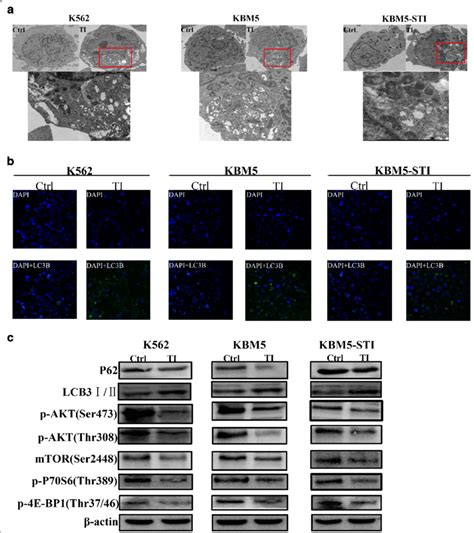 Tigecycline Induces Autophagy Of Cml Cells By Downregulating The