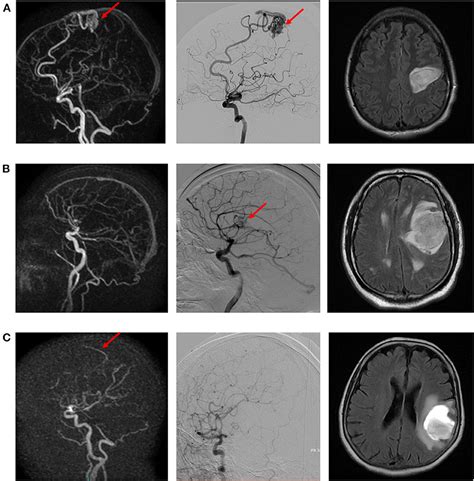 Frontiers Diagnostic Performance Of Dynamic 3d Magnetic Resonance