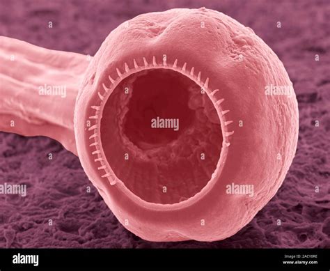 Chabertia Roundworm Coloured Environmental Scanning Electron Micrograph Esem This Parasitic