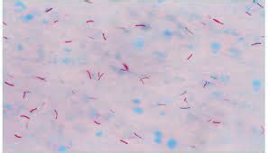 Acid Fast Bacilli Staining (AFB)* | Maurya Labs