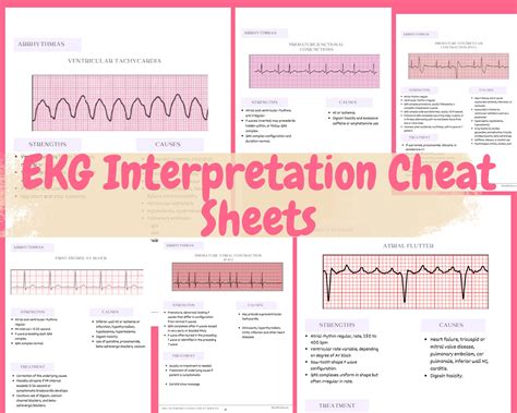 Ecg Interpretation Cheat Sheet What Exactly Is An Ecg An