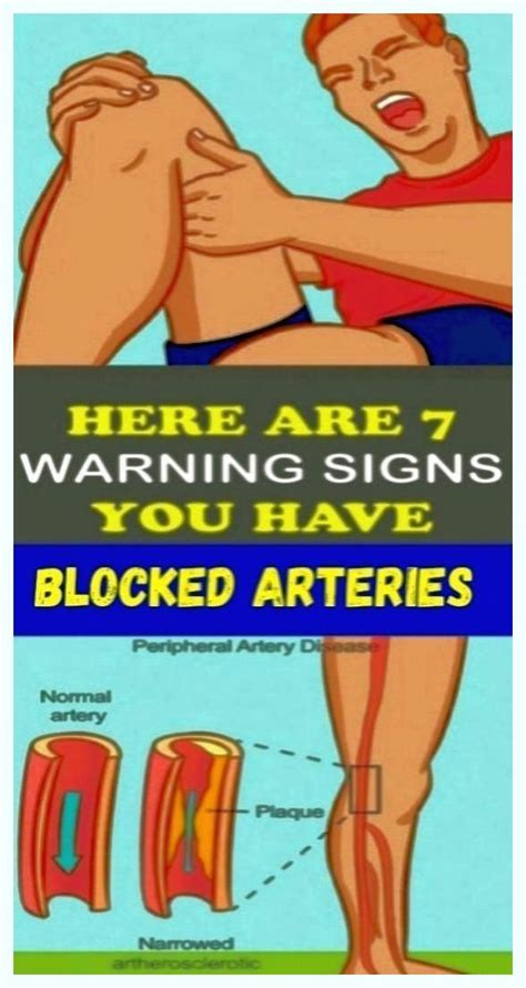 Here Are 7 Warning Signs You Have Blocked Arteries Arteries Clogged