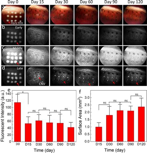 Multimodal Imaging Of Laser Induced Choroidal Neovascularization In