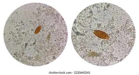 Eggs Trichuris Trichiura Whipworm Stool Analyze Stock Photo 2220643241 ...