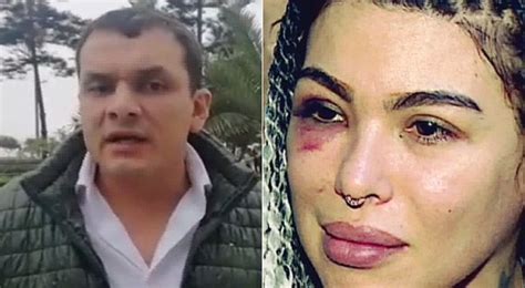 Supuesto Agresor De Angie Jibaja Desmiente A La Modelo Y Asegura Que