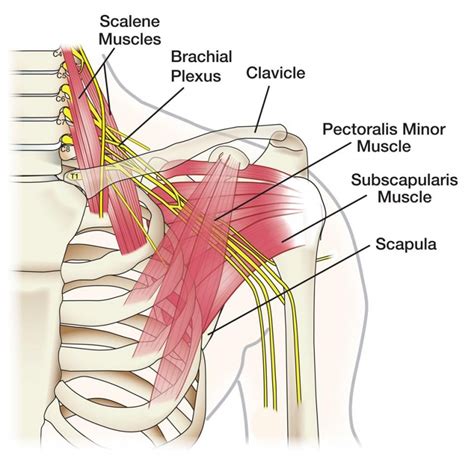 Best Physiotherapy Treatment for Brachial Plexus in Gurgaon