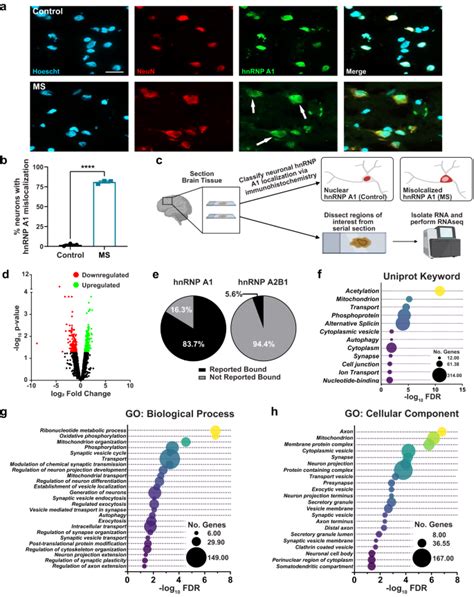 Hnrnp A Dysfunction Alters Rna Splicing And Drives Neurodegeneration