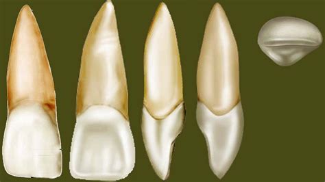 Maxillary Central Incisor Anatomy