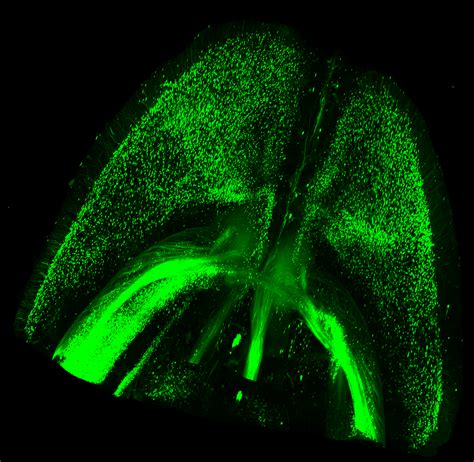 light sheet microscopy