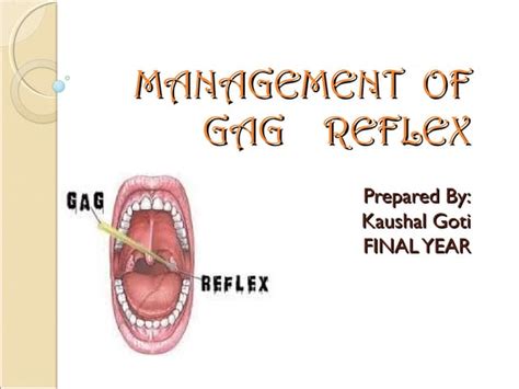 Gag Reflex Management Ppt