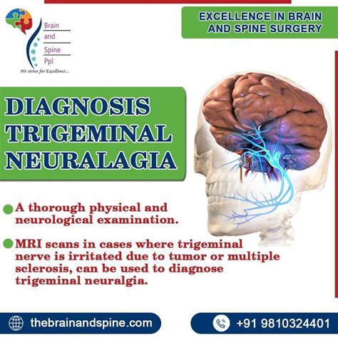 Diagnosis of Trigeminal Neuralgia | Trigeminal neuralgia, Neuralgia ...