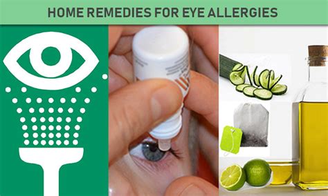 Eye Allergies Home Remedies Relief